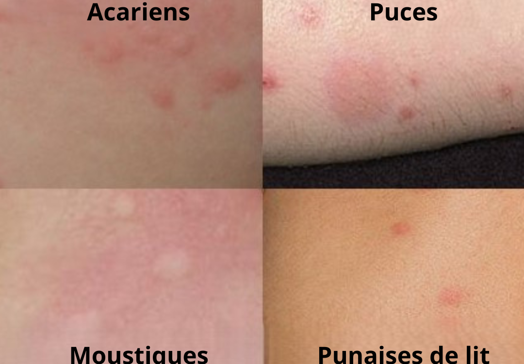 Quels sont les signes m&eacute;connus d&rsquo;une infestation de punaises de lit ? Lingolsheim