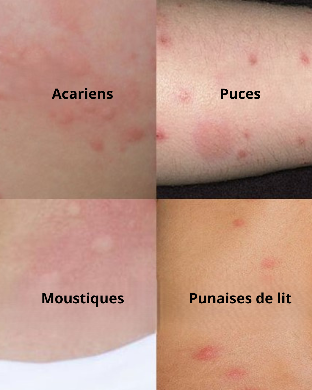 Comment identifier les piqûres de punaises de lit ? Obernai 3